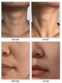 Elizabeth Arden RETINOL + HPR Ceramide Capsules-14ml /30 Capsules - 14ml - View 8