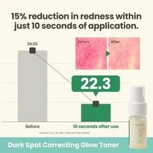AXIS-Y طقم الإضاءة الصغير الثلاثي - Collagen - مشاهدة 4