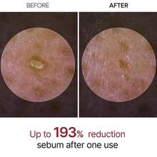 Dr.Melaxin White Rice Exfoliating Ampoule 80ml - Hyaluronic Acid - View 3