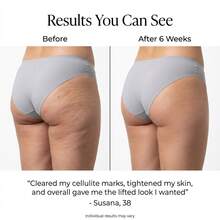 4-In-1 Body Sculptor - Body Sculpting Massager For Stomach, Arms, Legs, & Love Handles - Anti Cellulite Massage Too, Lymph Drainage Machine, & Skin Tightening Device - 粉色 - 查看 5