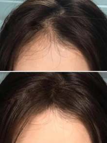 3PCS/SET Hairline Sticks Waterproof And Sweatproof Filling Hairline Contouring Powder, Hair Shading Powder, Touch-Up For Thinning And Gray Hair, Instant Concealer, Multi-Contour Concealer Powder - 彩色 - 查看 3