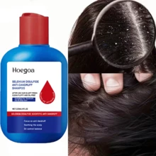 120ml Dandruff Removing Shampoo,Deep Cleans, Refreshes Scalp, For All Hair Types, Especially Oily Hair,For Women And Men,Strengthens Hair Roots,Moisturizes Herbal Hair Care Oil,Selenium Sulfide Shampoo,Scalp Shampoo - Dầu gội đầu - Xem 2
