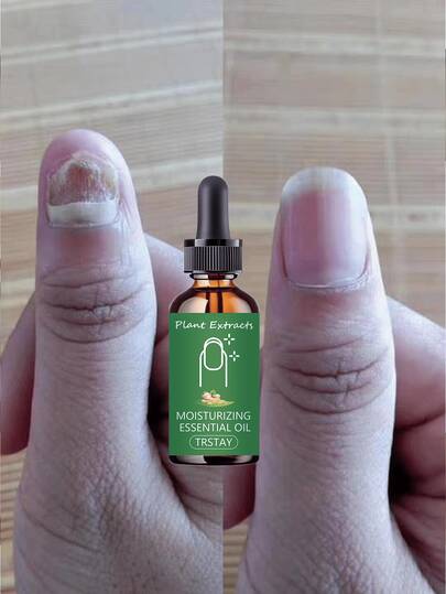 Tratamiento de cutículas hidratante intensivo con aceite, con vitamina E y aceite de jojoba. Hidrata, fortalece las uñas y promueve un crecimiento saludable para el cuidado diario de las uñas.