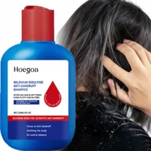 120ml Dandruff Removing Shampoo,Deep Cleans, Refreshes Scalp, For All Hair Types, Especially Oily Hair,For Women And Men,Strengthens Hair Roots,Moisturizes Herbal Hair Care Oil,Selenium Sulfide Shampoo,Scalp Shampoo - Dầu gội đầu - Xem 1