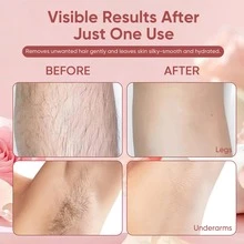 Bare Basics No Shave Hair Removal Cream For Women – Painless & Flawless Depilatory Cream For Body, Legs, Arms & Underarms, Gentle Formula With Vitamin E & Vitamin B5, Suitable For Sensitive Skin, Travel Essential, Skin Care Tools - Cream - View 5
