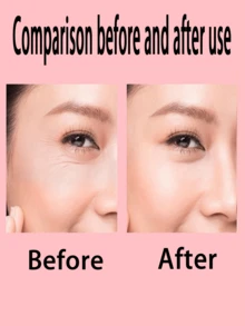 2pcs Reusable Silicone Anti-Wrinkle Patches, For Face Lifting & Tightening, Smoothing Wrinkles, Overnight Fine Line Removal, Facial Beauty Tool - Multicolor - View 3