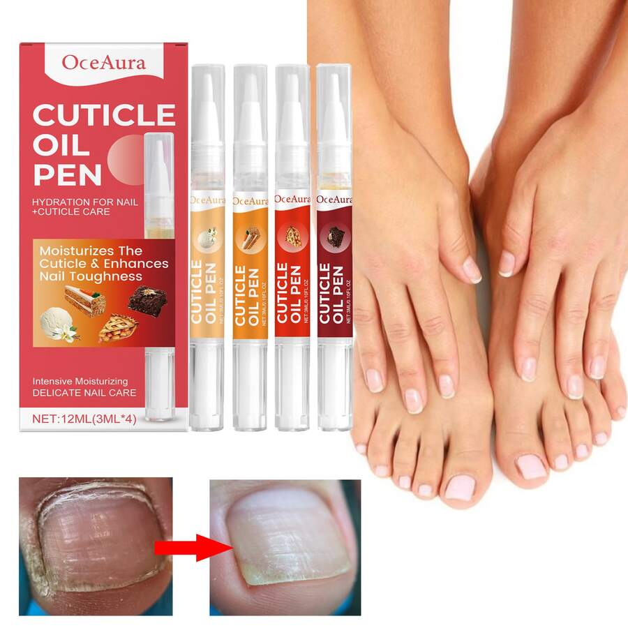 1 Set,Nail Surface Keratin Care, Deeply Nourishes Nails, Brightens Nails, Strengthens Nail Thickness, Suitable For Weak Nails - bộ - Xem 1