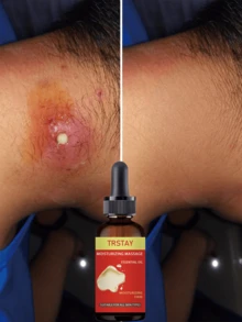 Natural Essential Oil For Soft Smooth Skin Alcohol Free Strong Moisturizing Quick Absorption Formula Daily Care With Organic Ingredients Hydrating Nourishing Treatment - 多色的 - 查看 4
