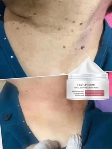 Alcohol-Free Moisturizing Vitamin E Enriched Night Body Cream Fragrance Free Deep Hydration Long Lasting Nourishment For Smooth Elastic Skin Whitening Effect Soothes Stubborn Micro Particles Intensive Hydration Therapy For Dry Skin Repair - Multicolor - 查看 6