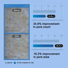 [ MEDICUBE ] Zero Pore Serum 2.0 37ml / 1.25 Fl.Oz - Ham mê - Xem 5