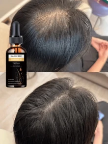 Hair Treatment Oil Light Liquid Essence Deep Moisturizing Firming Alcohol Free Mild Formula Non Irritating Refreshing Hair Care For All Hair Types Contains Liquid Hair Treatment Oils Moisturizing Hair Treatment Oil Light Liquid Essence - 彩色 - 查看 2
