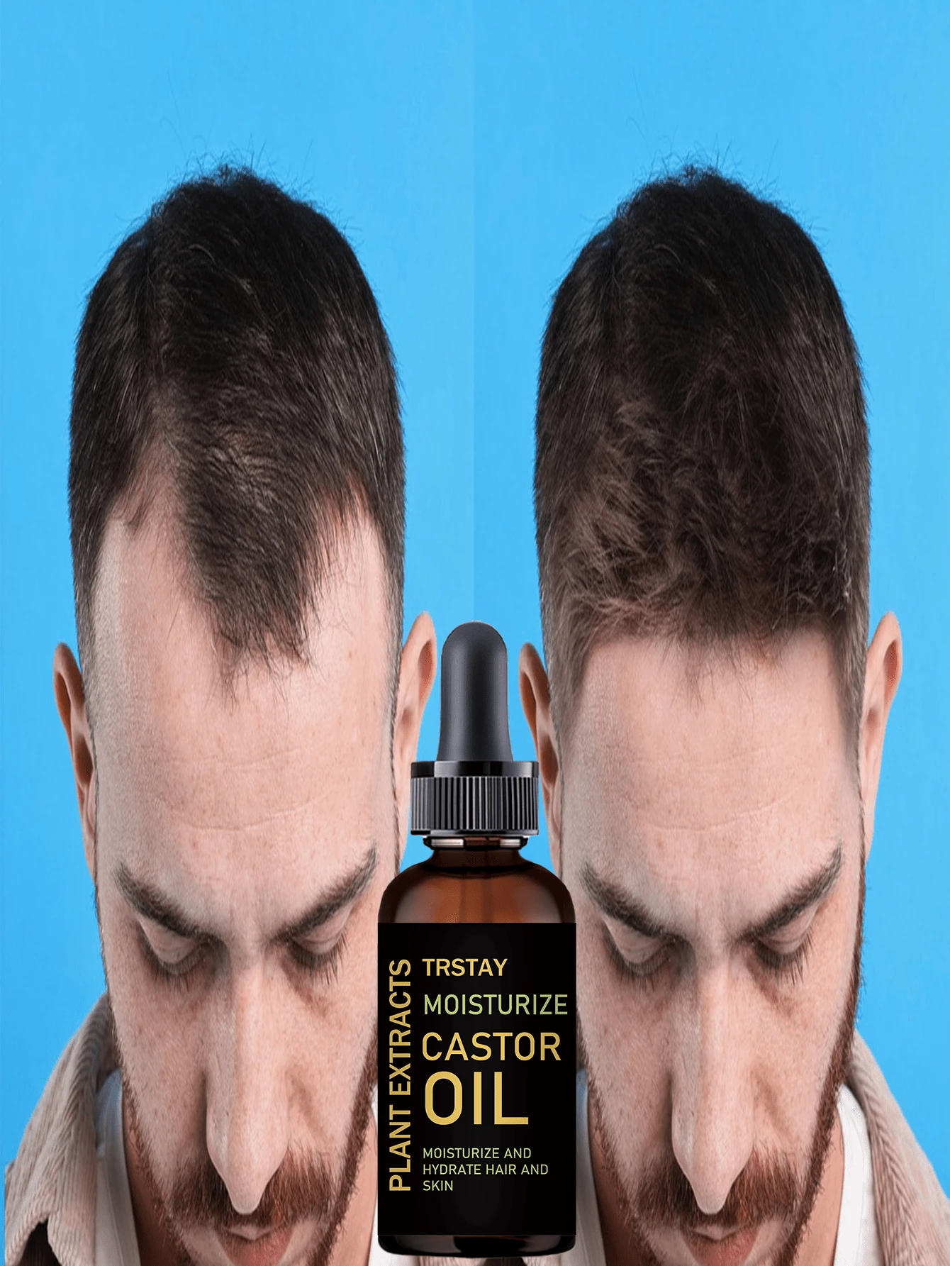 Castor Oil Hair Care Serum - Alcohol-Free, Lightweight & Non-Greasy, Infused With Multiple Plant Extracts | Gentle Hair Nourishment, Helps Thin Hair Look Fuller, Voluminous & Fortified - 彩色 - 查看 1