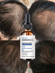 Hair Care Serum & Hair Oil - Enriched With Argan Oil, Jojoba Oil & Grapeseed Oil, Non-Greasy & Refreshing, Helps Sparse Hair Look Fuller And Thicker. - Nhiều màu - Xem 3