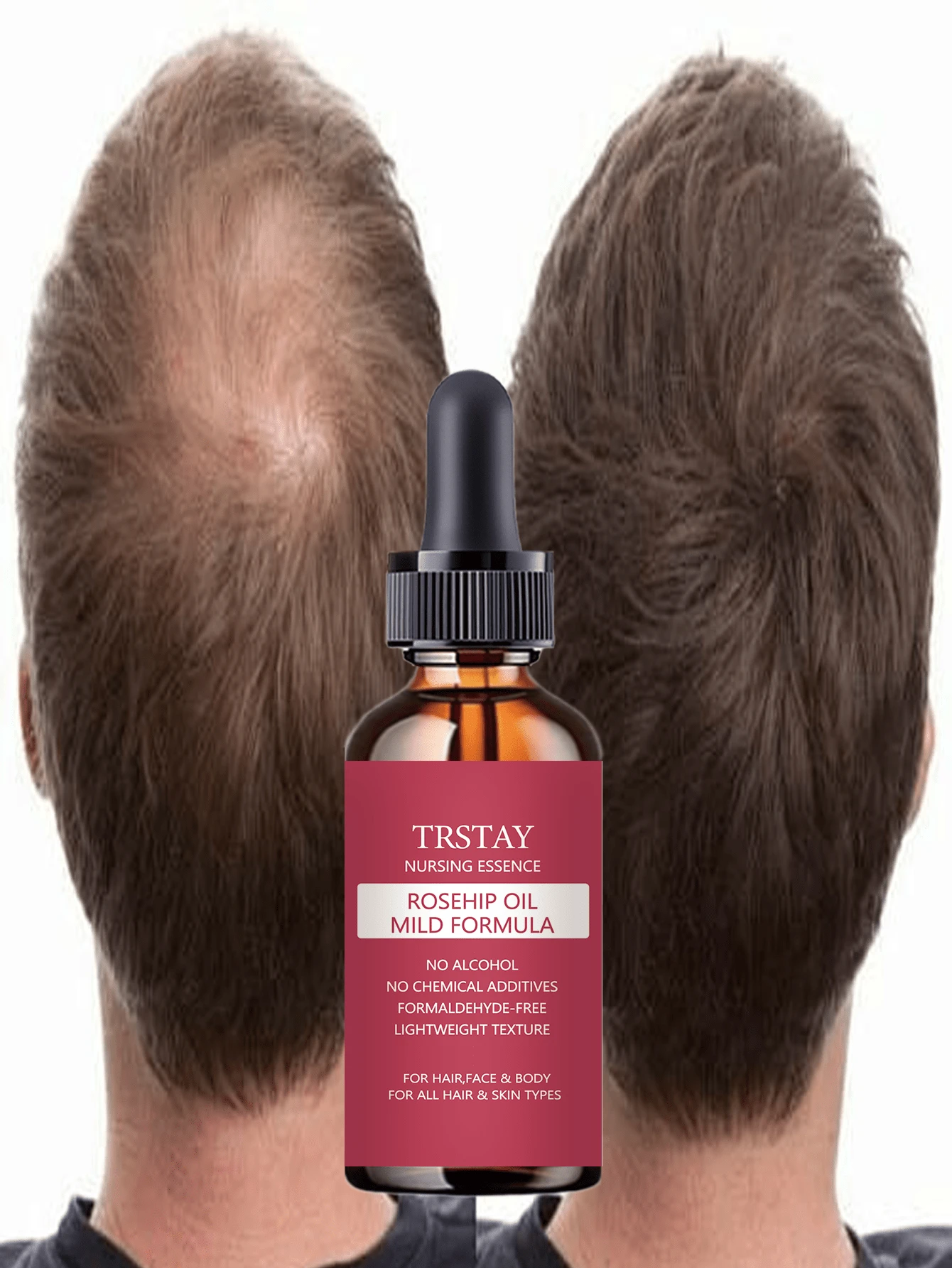 TRSTAY 10 In 1 Hair Care Serum & Hair Oil - Enriched With Multiple Hair-Nourishing Botanical Extracts, Gentle Formula, Helps Sparse Hair Look Fuller And Thicker. - 彩色 - 查看 1