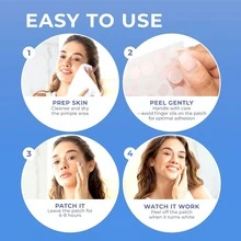 Water Gel Acne Patch, Non-Alcoholic, Odorless, Mild And Non Irritating Acne And Blemishes Covering Sticker, Acne Patch, Holiday Gift - Multicolor - View 8