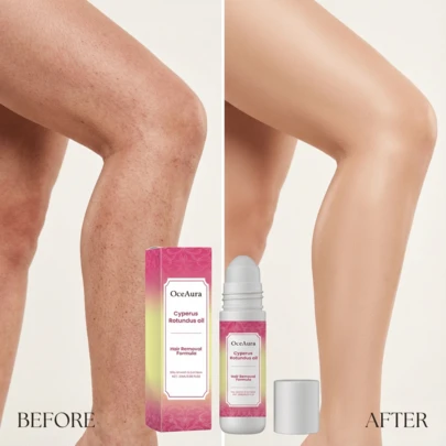 OceAura 柠檬草精氨酸脱毛后舒缓护理油 - 温和镇静肌肤，减少毛发再生，轻盈滚珠设计，令肌肤光滑、滋润、舒适。