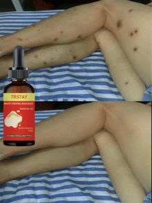 Natural Ingredient Alcohol Free Moisturizing Essence With Strong Moisturizing And Quick Absorption Formula For Soft Smooth Skin Daily Care Hydration Boost Non Greasy Lightweight - Multicolor - View 5