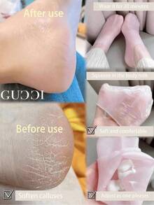 1 Pair Silicone Moisturizing Foot Socks, Effectively Care For Feet, Prevent Cracked Heels, Remove Dead Skin, Elastic Foot Socks, All-Day Moisture Locking, Prevent Dryness, Odorless, Easy To Wear And Take Off, Soft And Comfortable Material. - Multicolor - View 7