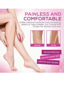 1pc Unisex Reusable Crystal Hair Remover, Painless Exfoliating & Depilatory Tool, Women's Painless Physical Crystal Epilator, Glass Depilator, All Season Unisex Crystal Hair Removal Device, Painless Epilator, Portable Gentle Depilator, Gentle Exfoliation, Magical Depilation Tool - Multicolor - View 5