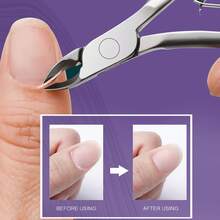 1pc Professional Portable Callus Remover, Ultra Sharp, Easy Nail Trimming - Unisex Home & Salon Nail & Toe Nail Clipper Tool - Multicolor - View 2