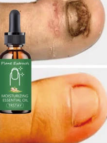 TRSTAY Nail Moisturizing Essence, Mild And Non Irritating, Alcohol Free And Essence Free, Refreshing And Moisturizing - Multicolor - View 4