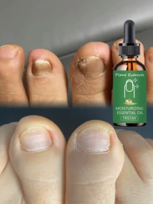 TRSTAY Nail Moisturizing Essence, Mild And Non Irritating, Alcohol Free And Essence Free, Refreshing And Moisturizing - Multicolor - View 5