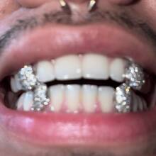 THATBOY Satu set berisi 4 Grillz bergaya Hip Hop yang terbuat dari tembaga dengan inlay zirkonia sintetis, aksesori berkilau untuk perhiasan. Hadiah untuk artis rap dan hip hop, cocok untuk pria dan wanita. - MultiWarna - View 3