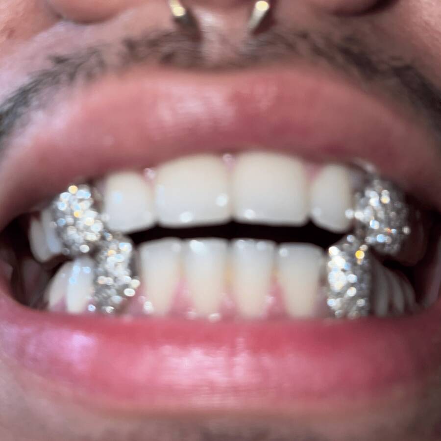 THATBOY Satu set berisi 4 Grillz bergaya Hip Hop yang terbuat dari tembaga dengan inlay zirkonia sintetis, aksesori berkilau untuk perhiasan. Hadiah untuk artis rap dan hip hop, cocok untuk pria dan wanita.
