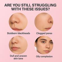 【焕肤洁面】PDRN啫喱泡沫洁面乳，温和氨基酸洗面奶，神经酰胺修护受损屏障，玻尿酸深层补水，抑制黑头，提亮肤色，疏通毛孔，改善黑头，打造饱满透亮肌肤 - 全部 - 查看 2