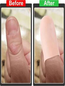 4 peças/8 peças/16 peças Dedeira de Silicone Reutilizável e Almofada de Gel, Elástica e Confortável, Adequada para Esportes, Jardinagem, Trabalho, Capa Protetora Durável e Confortável para Mãos e Pés - Visão 6