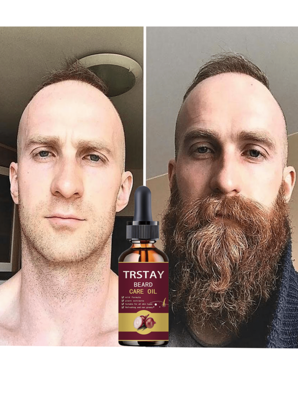 TRSTAY Onion Plant Extract Beard Essence, A Variety Of Mild Plant Formulas, Help Maintain The Healthy Beard, Make The Sparse Beard Look Thicker