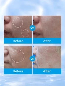 La Roche-Posay 理肤泉 Cicaplast Baume B5 40ml，舒缓修护，针对敏感、受刺激肌肤 - 15ml*2 - 查看 3