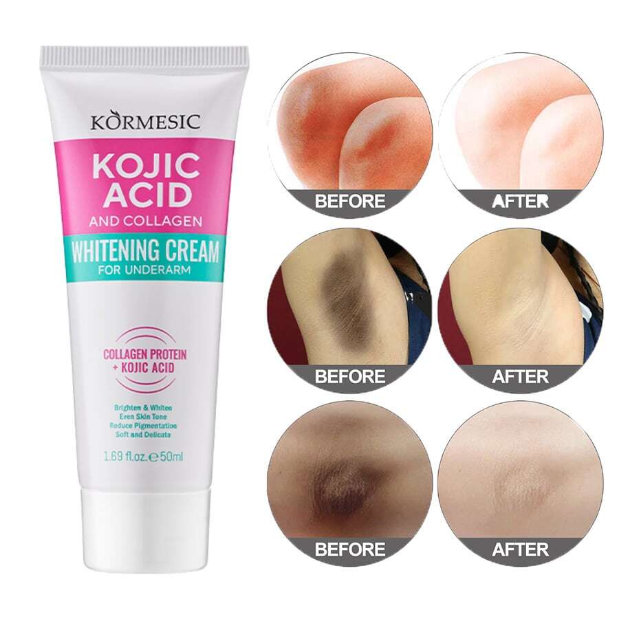 2支胶原蛋白腋下美白霜，可用于腋下、膝盖、手肘等部位，蕴含植物提取物和胶原蛋白，可美白、保湿、修复干燥肌肤，淡化暗沉部位，滋润提亮肤色。 - 多款 - 查看 1