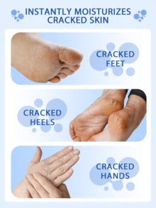 AURANY 100克 60% 尿素足霜 + 水杨酸，保湿尿素足霜，适用于厚重、干裂、粗糙的足部皮肤，改善干燥皮肤，补充水分，使皮肤更容光焕发、紧致，可作为圣诞节或情人节礼物送给男士/女士，男女通用，适合所有肤质。 - 彩色 - 查看 3