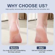 Rechargeable Electric Callus Remover, Foot File With 2 Replacement Rollers, Adjustable Speed, Waterproof Foot Grinder, Perfect For Removing Dead Skin, Calluses, Cracked Heels (With Display Screen) - Multicolor - View 4