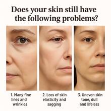 【焕活紧致，抚平皱纹，提亮肤色】HPR视黄醇精华液，蕴含烟酰胺和氨甲环酸的先进配方，改善细纹，提亮肤色，舒缓修护面部精华液 - 全部 - 查看 6