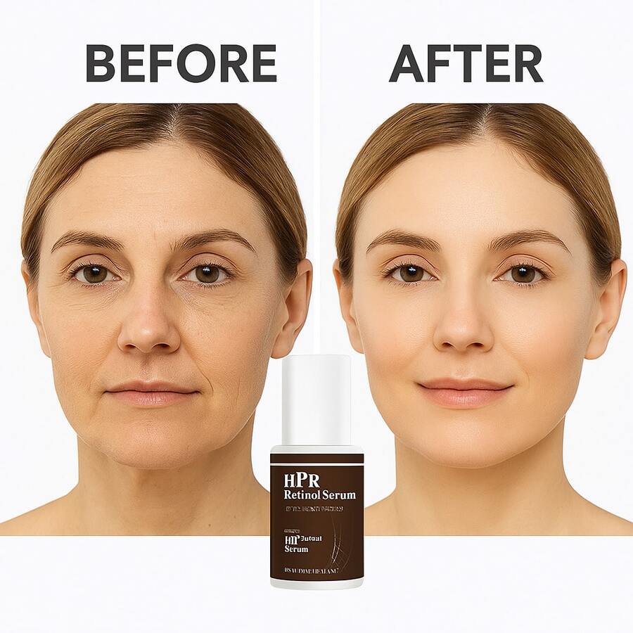 【焕活紧致，抚平皱纹，提亮肤色】HPR视黄醇精华液，蕴含烟酰胺和氨甲环酸的先进配方，改善细纹，提亮肤色，舒缓修护面部精华液 - 全部 - 查看 1