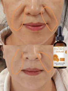 Niacinamide Whitening Serum Alcohol-Free Professional Facial Treatment For Bright Hydrated Skin Moisturizing Care Serum To Even Skin Tone And Glow - 彩色 - 查看 2