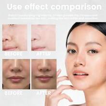 20 Pieces Facial Lines Smoothing Patches. Reduce Fine Lines, Lift And Firm The Facial Skin. Strong Adhesion, Portable Design. - Multicolor - View 5