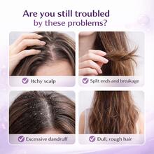 红洋葱洗发水 - 控油、深层清洁、去屑止痒、强韧发丝、保湿滋养，蕴含迷迭香油和肉桂成分 - 滋養 - 查看 2