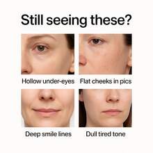 Veloferine 面部精华，丰盈紧致，胶原蛋白精华，针对肌肤凹陷 - 全部 - 查看 7