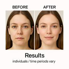 Veloferine 面部精华，丰盈紧致，胶原蛋白精华，针对肌肤凹陷 - 全部 - 查看 9