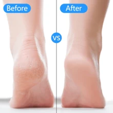 1 par silikonhälskydd, andningsbara, återfuktande hälskydd, mjuka och elastiska, passar olika skor - Vitt - Visa 4