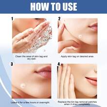 144 Invisible Hydrocolloid Patches - Acne And Acne Concealer Stickers For The Face, Mild And Non Irritating - View 6