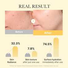 Medicube Kojic Acid Turmeric Brightening Gel Mask - Pack Of 4 Masks - Hyaluronic Acid - View 3