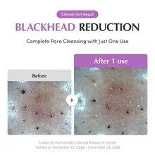 Purple Rice Pore Purifying Cleanser - 130g - Nettoyant - View 6