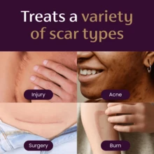 Mederma Advanced Scar Gel Skin Protectant Reduce Appearance Of Old & New Scars - 1 - View 4