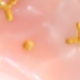 多色A