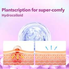 432 piezas/caja Parches de acné con forma de estrella de amor de hidrogel, sin alcohol, insípidos, no irritantes, que cubren el acné y los defectos, parches de acné de alta calidad con ácido salicílico y aceite de árbol de té, regalos navideños - Multicolor - Ver 7