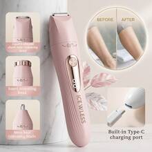 Women's 3-In-1 Hair Removal Device, Combines Shaver And Trimmer, Electric Underarm Hair Removal Device, Intimate Area Hair Removal, Gentle And Efficient, Rechargeable, Fully Automatic Hair Removal Device, Suitable For Shaving And Hair Removal - Multicolor - View 2